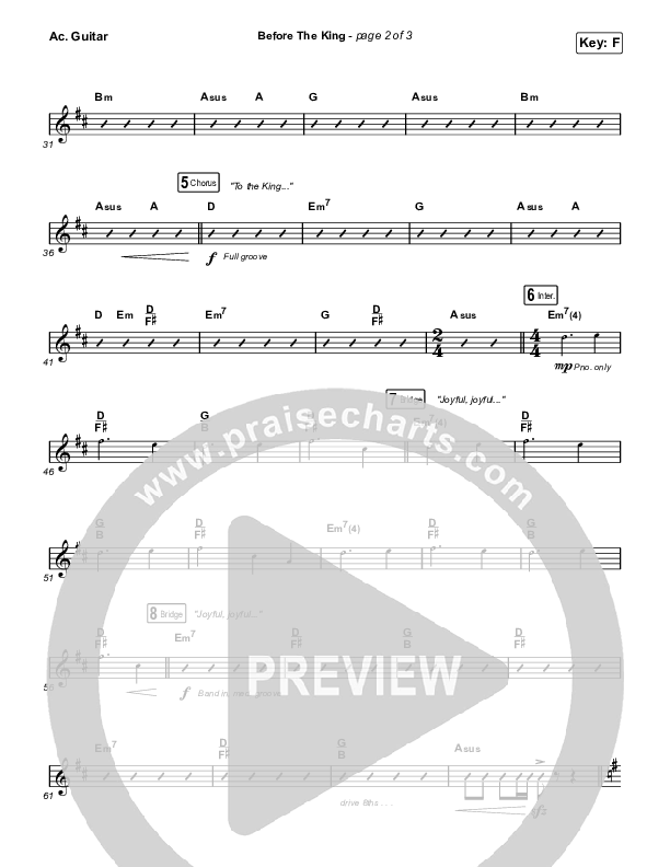 Before The King Acoustic Guitar (Saddleback Worship)