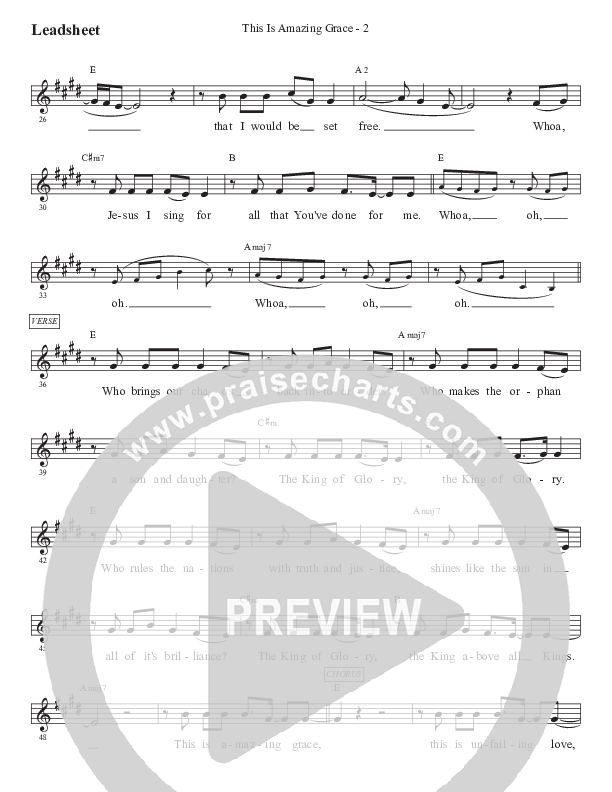 This Is Amazing Grace (Kids) Lead Sheet (Melody) (PraiseCharts Kids / Arr. Luke Gambill)