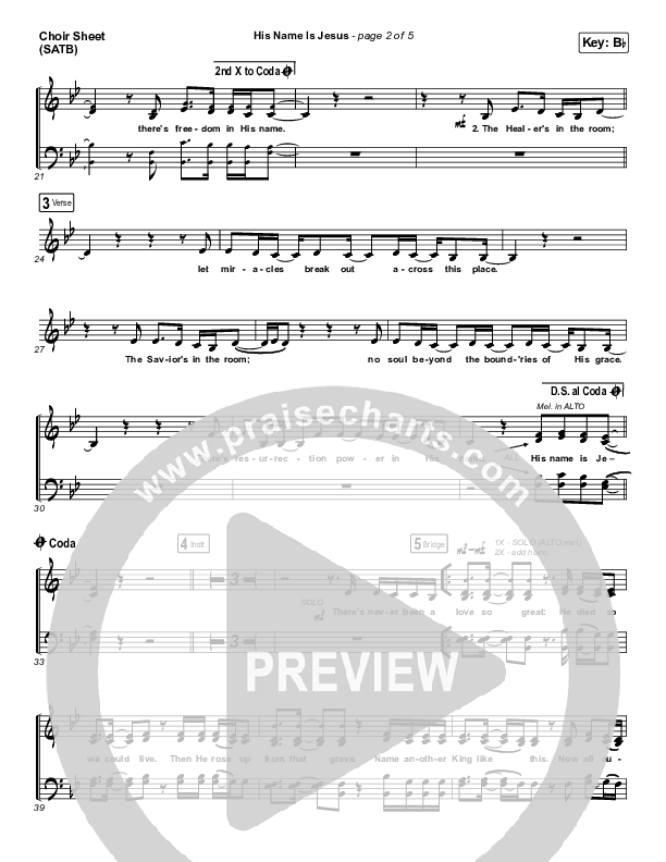 His Name Is Jesus Choir Vocals (SATB) (Phil Wickham)