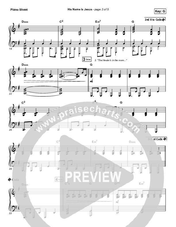 His Name Is Jesus Piano Sheet (Phil Wickham)