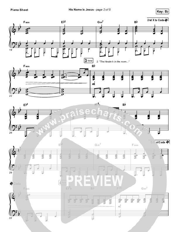 His Name Is Jesus Piano Sheet (Phil Wickham)