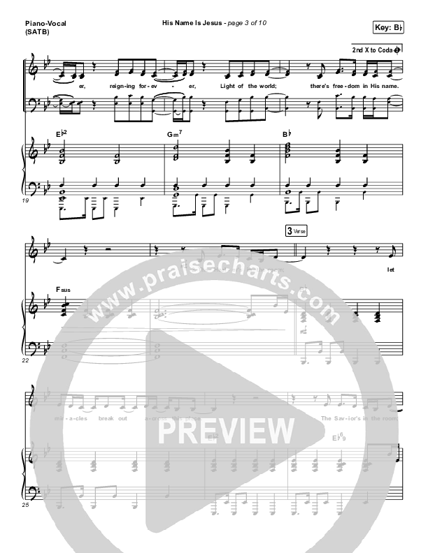 His Name Is Jesus Sheet Music Pdf Phil Wickham Praisecharts His Name Is Jesus Sheet Music Pdf Phil Wickham Praisecharts