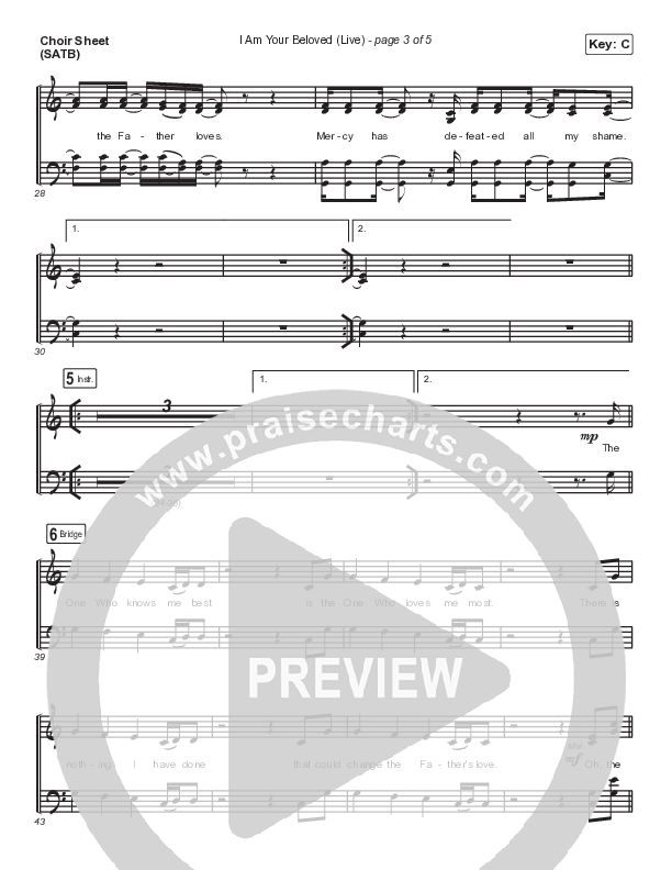 I Am Your Beloved (Live) Choir Vocals (SATB) (Jonathan David Helser / Melissa Helser)