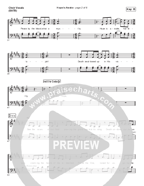 Hope Is Awake Choir Vocals (Anthem SATB) (Austin Stone Worship)
