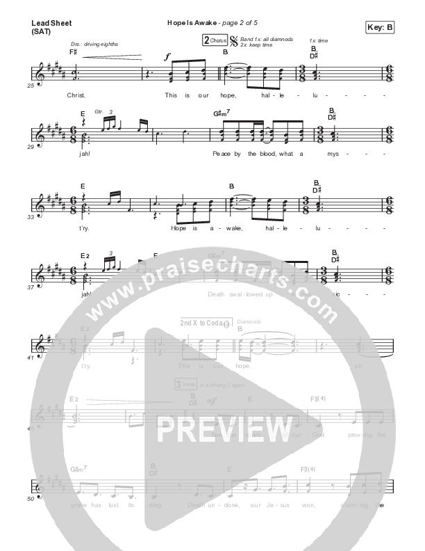 Hope Is Awake Lead Sheet (SAT) (Austin Stone Worship)