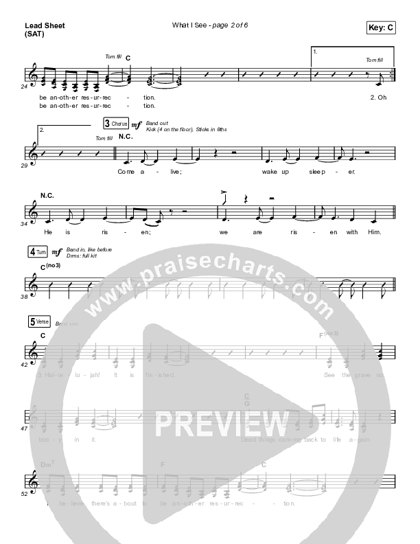 What I See (Choral Anthem SATB) Lead Sheet (SAT) (Elevation Worship / Arr. Mason Brown)