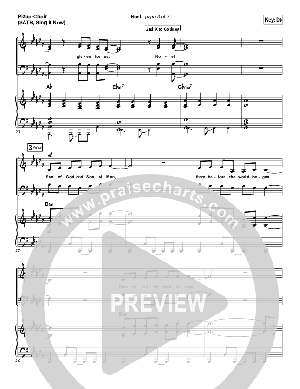 Noel (Sing It Now SATB) Piano/Choir (SATB) (Lauren Daigle / Arr. Mason Brown)