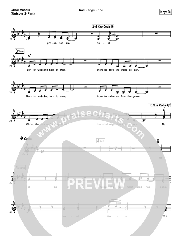 Noel (Unison/2-Part Choir) Choir Vocals (Uni/2-Part) (Lauren Daigle / Arr. Mason Brown)