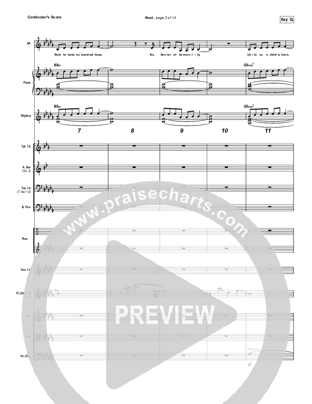 Noel (Unison/2-Part Choir) Conductor's Score (Lauren Daigle / Arr. Mason Brown)