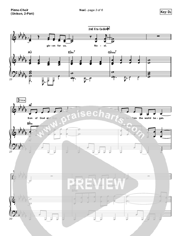 Noel (Unison/2-Part) Piano/Choir (Unison, 2-part) (Lauren Daigle / Arr. Mason Brown)