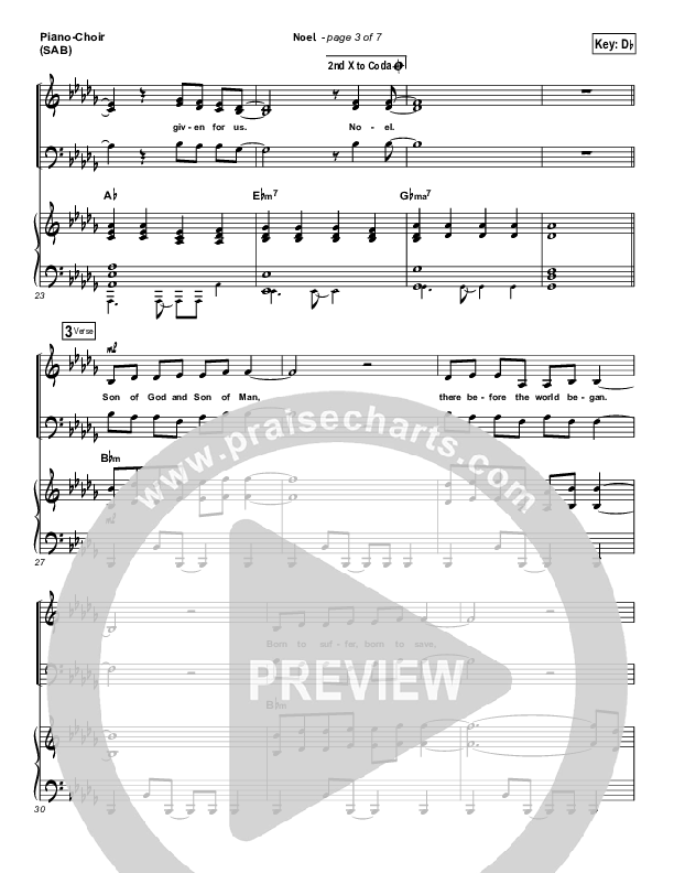 Noel (Worship Choir SAB) Piano/Choir (SAB) (Lauren Daigle / Arr. Mason Brown)