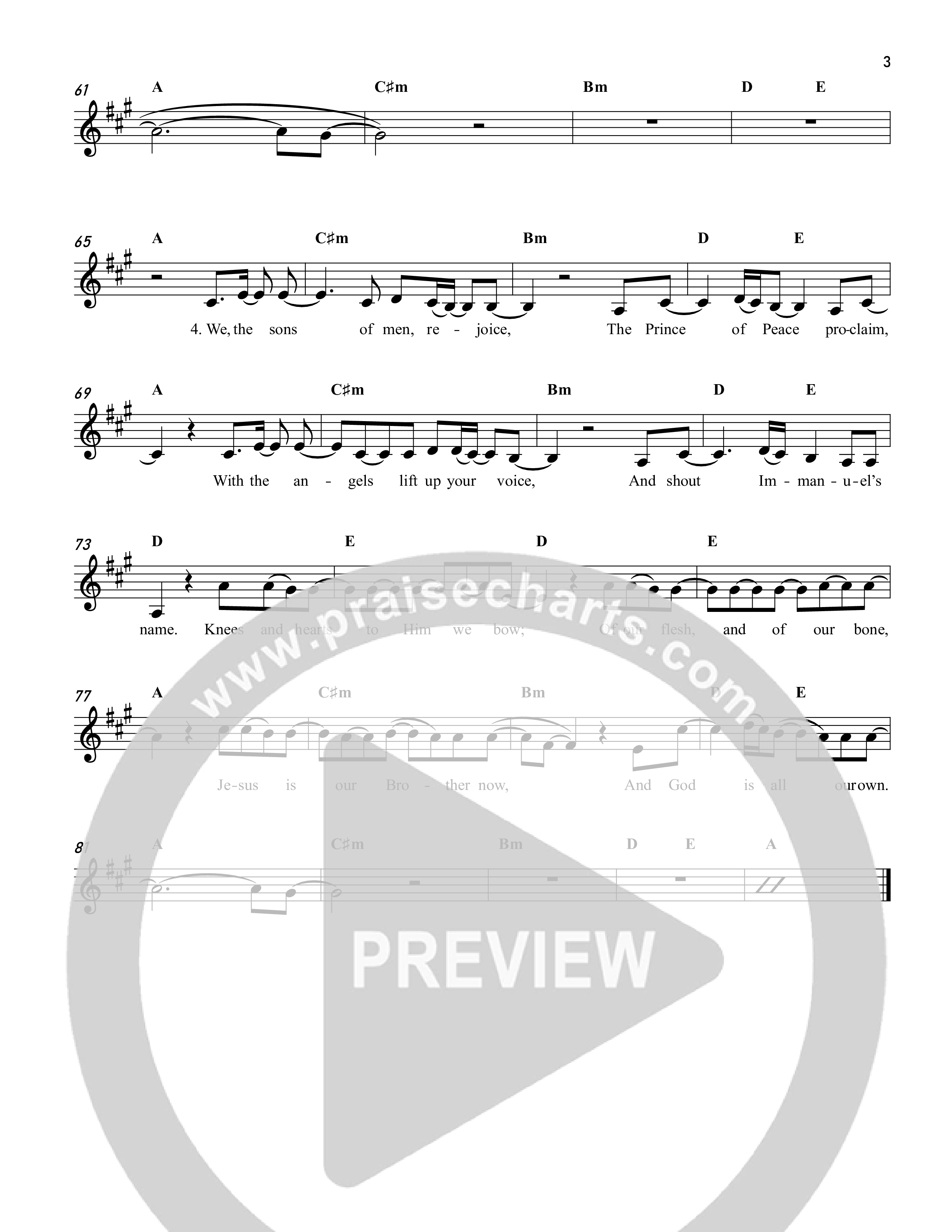 Glory Be To God On High Lead Sheet Melody (Reawaken Hymns)