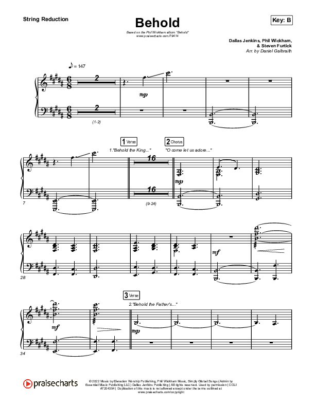 Behold String Reduction (Phil Wickham / Anne Wilson)