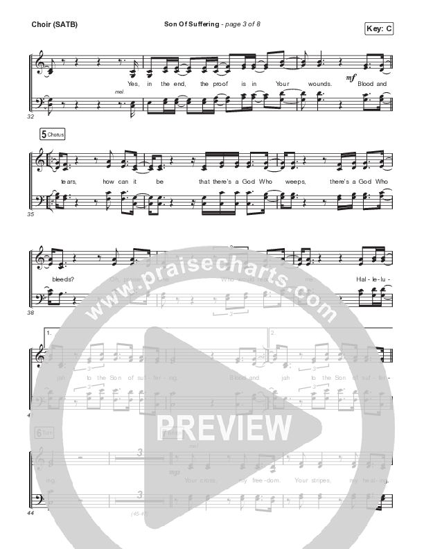 Son Of Suffering (Live) Choir Sheet (SATB) (Matt Redman)