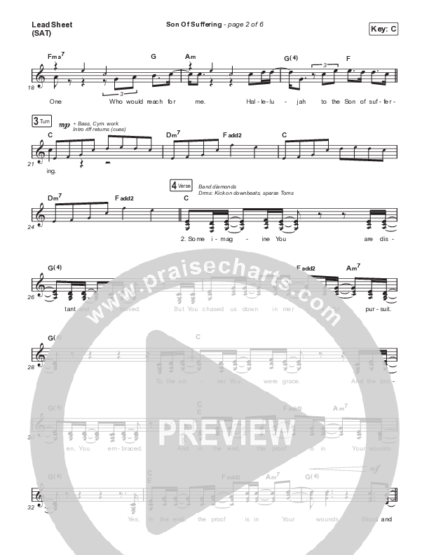 Son Of Suffering (Live) Lead Sheet (SAT) (Matt Redman)