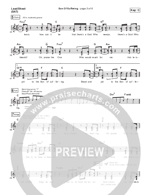 Son Of Suffering (Live) Lead Sheet (SAT) (Matt Redman)