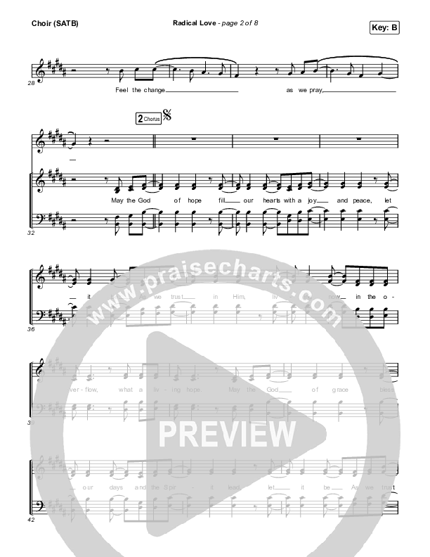 Radical Love Choir Sheet (SATB) (Stockholm Worship)