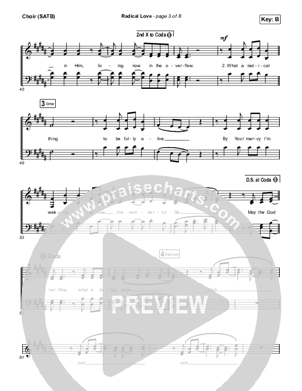 Radical Love Choir Sheet (SATB) (Stockholm Worship)
