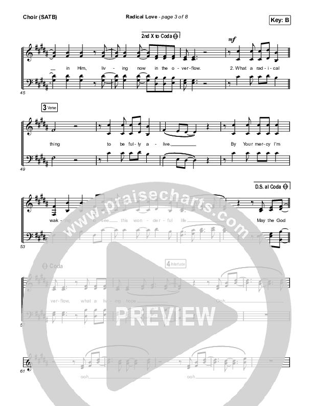 Radical Love Choir Sheet (SATB) (Stockholm Worship)