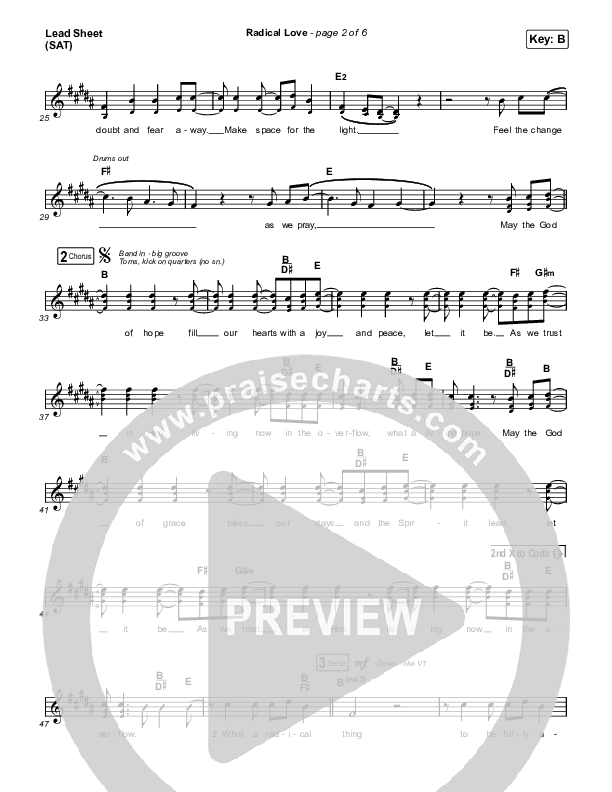 Radical Love Lead Sheet (SAT) (Stockholm Worship)