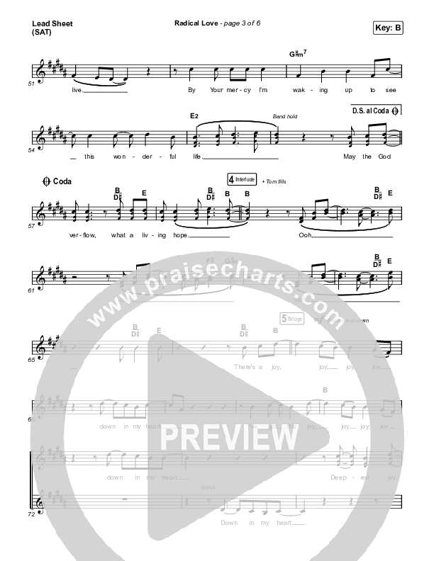 Radical Love Lead Sheet (SAT) (Stockholm Worship)