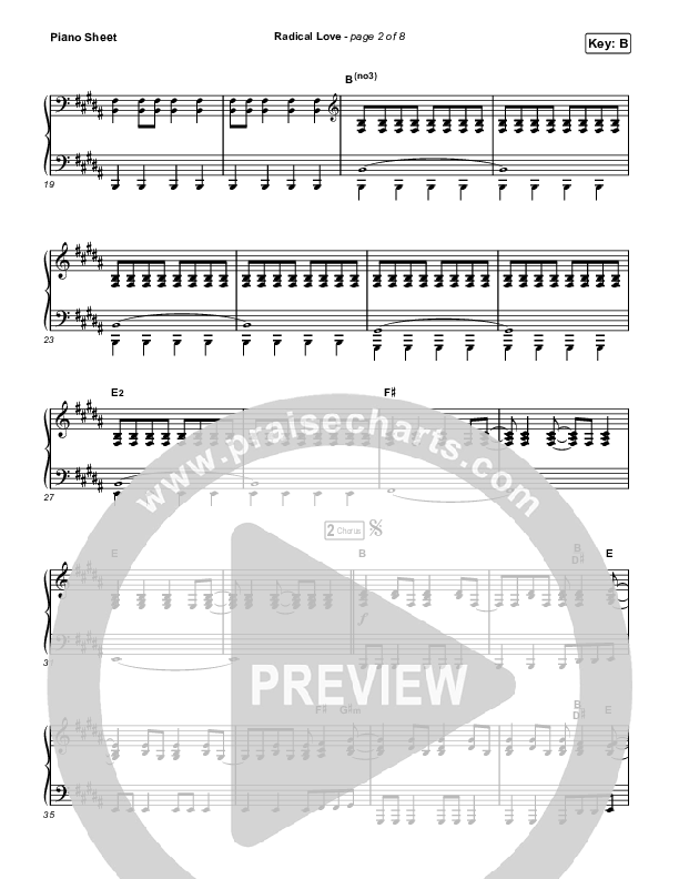 Radical Love Piano Sheet (Stockholm Worship)