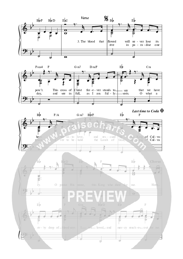 King Of Calvary (Live) Lead Sheet Melody (Matt Redman)