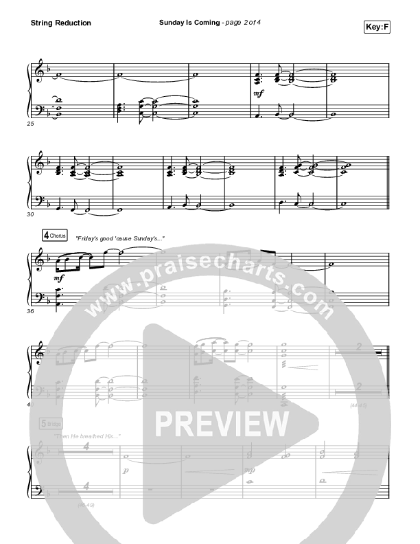 Sunday Is Coming (Worship Choir/SAB) String Reduction (Phil Wickham / Arr. Mason Brown)