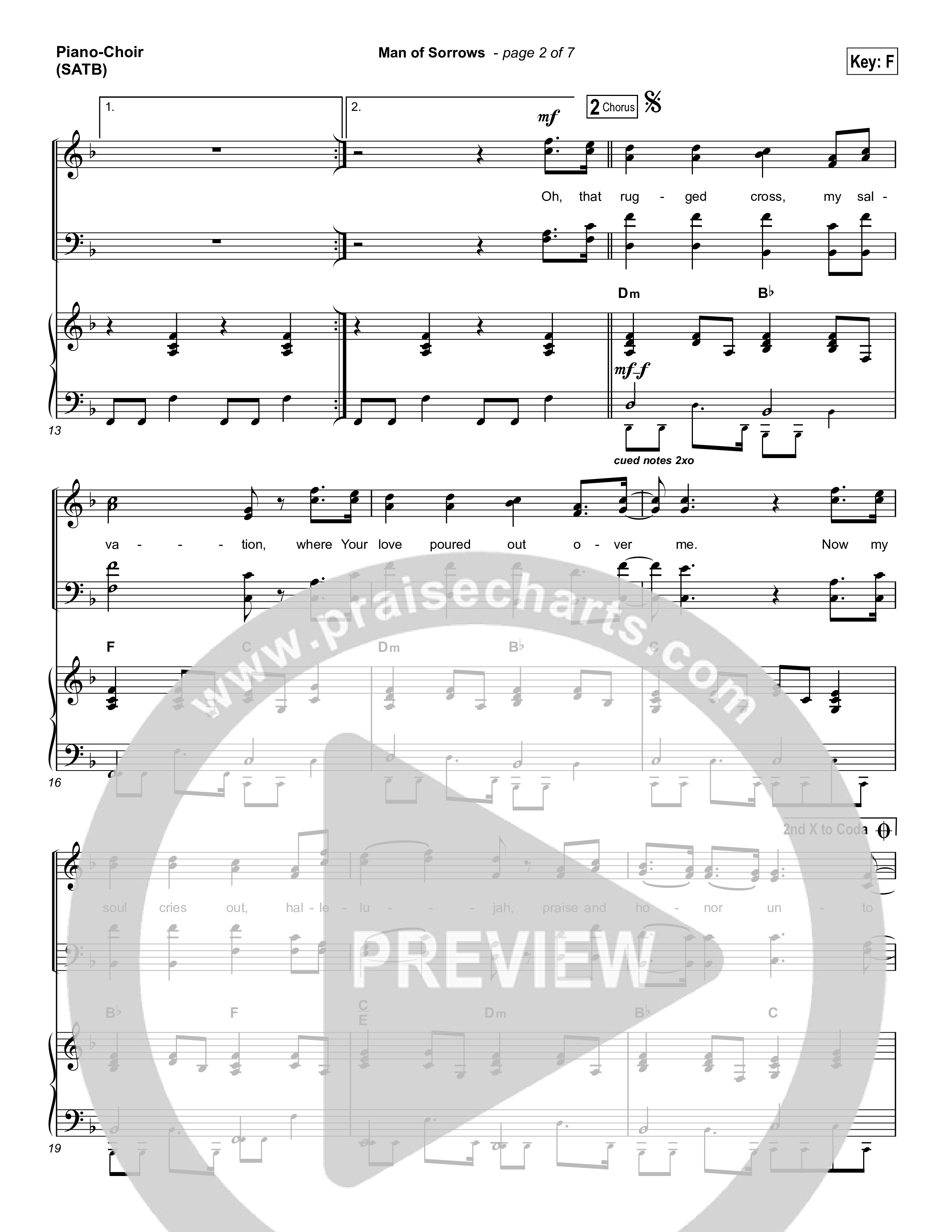 Man Of Sorrows (Choral Anthem SATB) Piano/Vocal (SATB) (Hillsong Worship / Arr. Erik Foster)