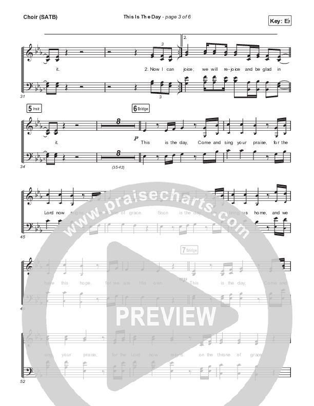 This Is The Day (Live) Choir Sheet (SATB) (CityAlight)