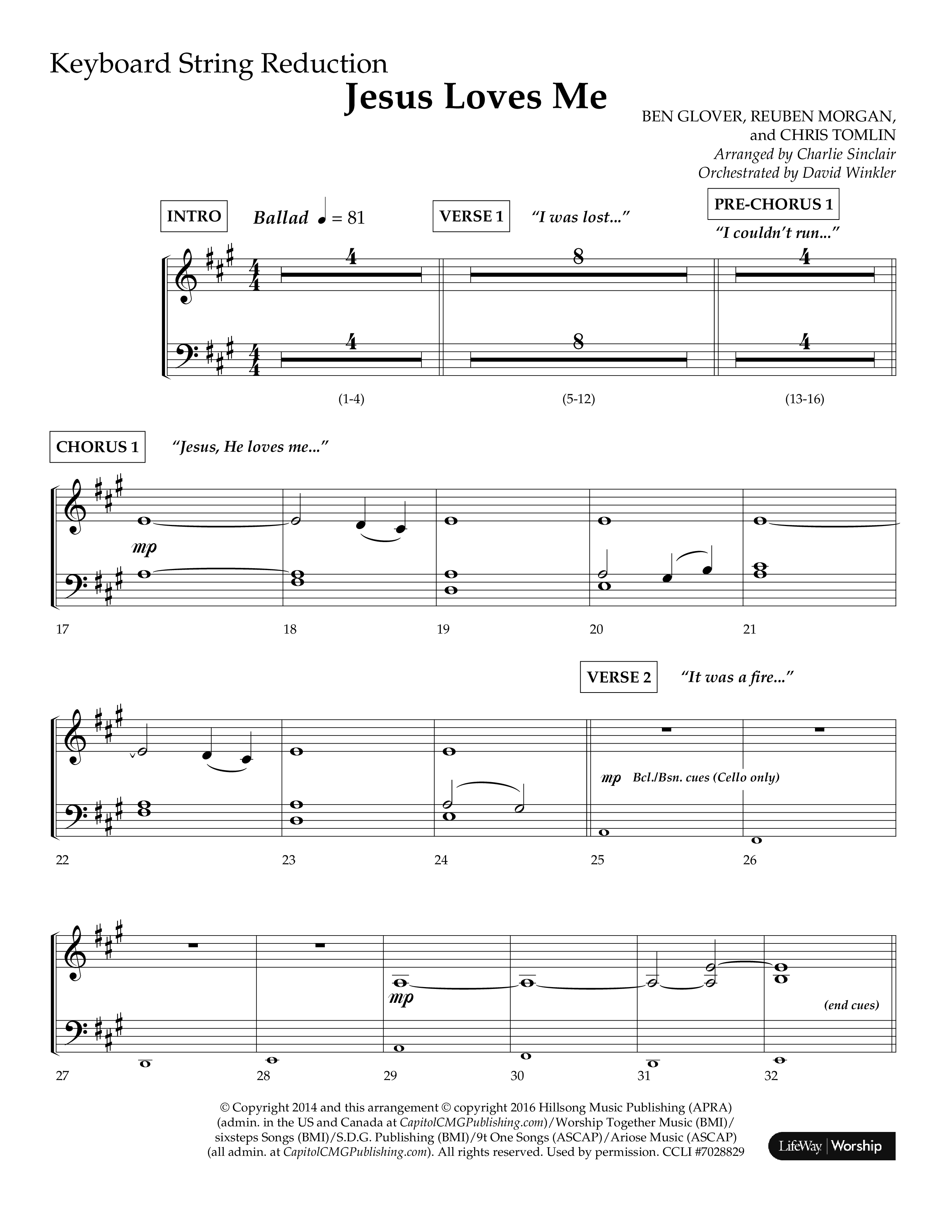 Jesus Loves Me (Choral Anthem SATB) String Reduction (Lifeway Choral / Arr. Charlie Sinclair / Orch. David Winkler)