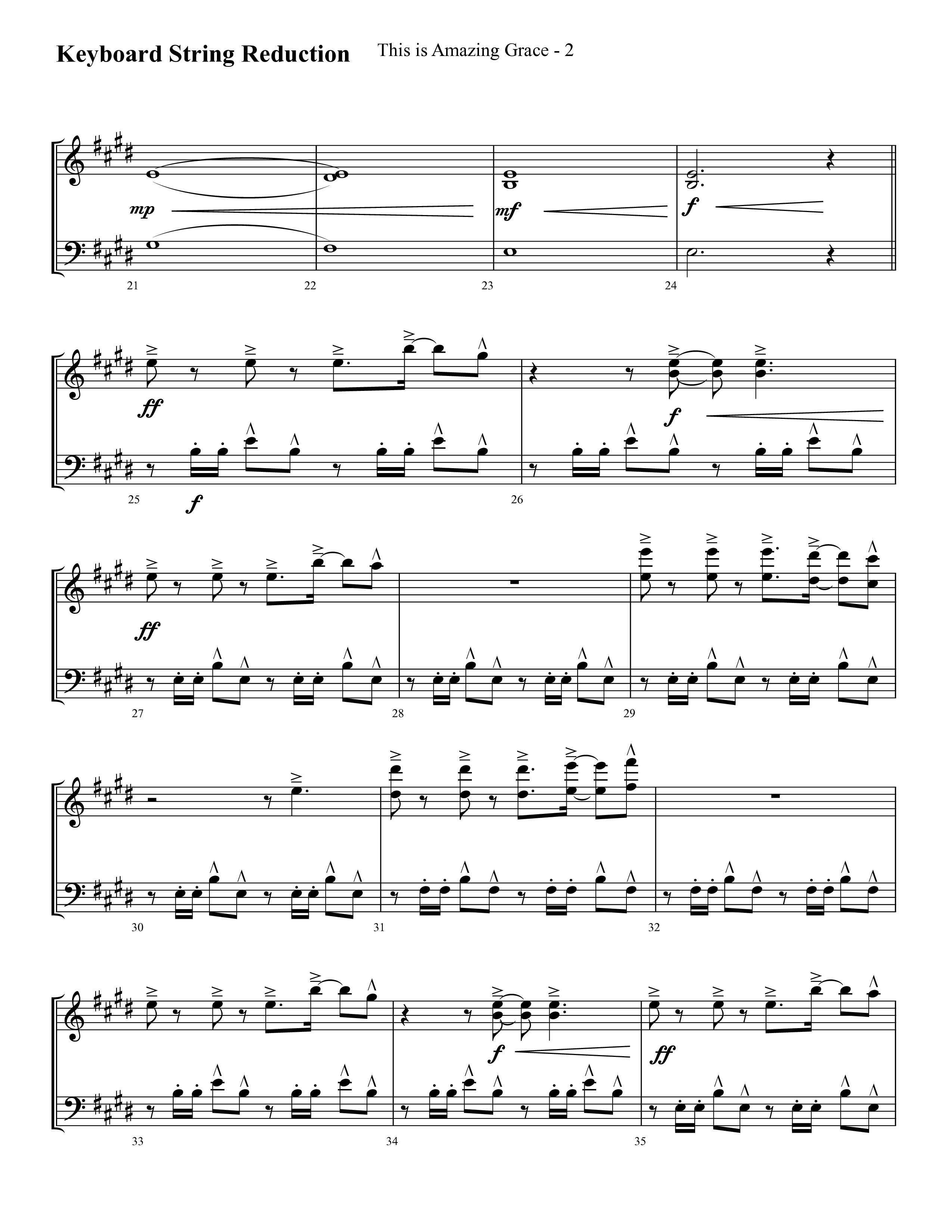 This Is Amazing Grace (Choral Anthem SATB) String Reduction (Lifeway Choral / Arr. Cliff Duren)