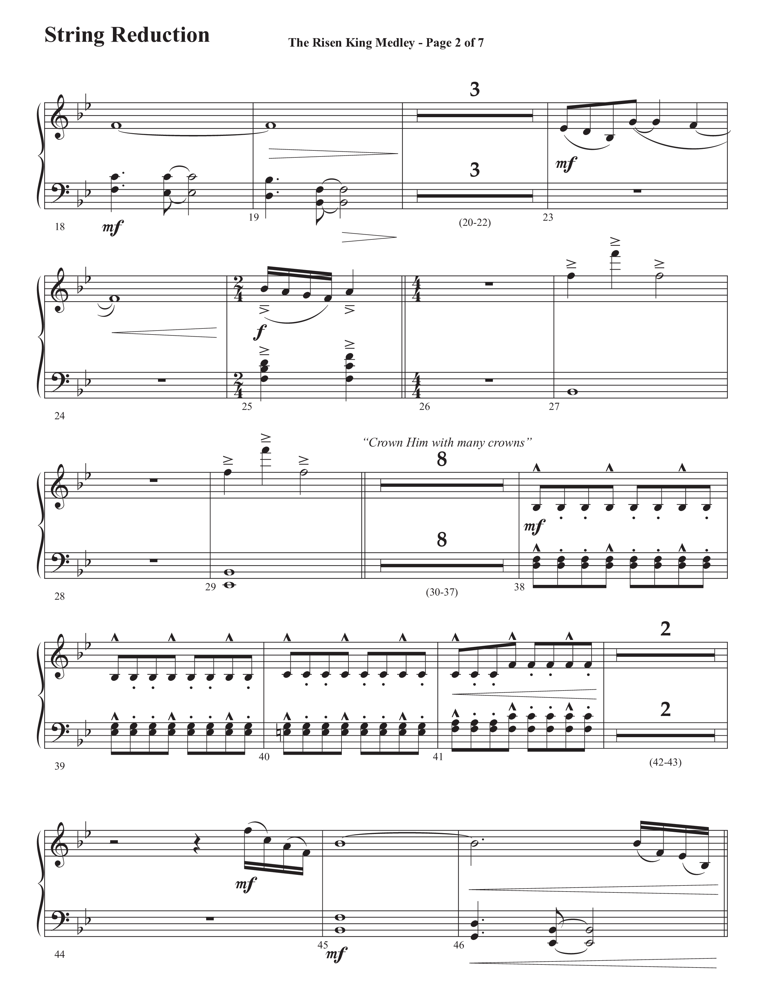 The Risen King Medley (Choral Anthem SATB) String Reduction (Semsen Music / Arr. John Bolin / Orch. Cliff Duren)
