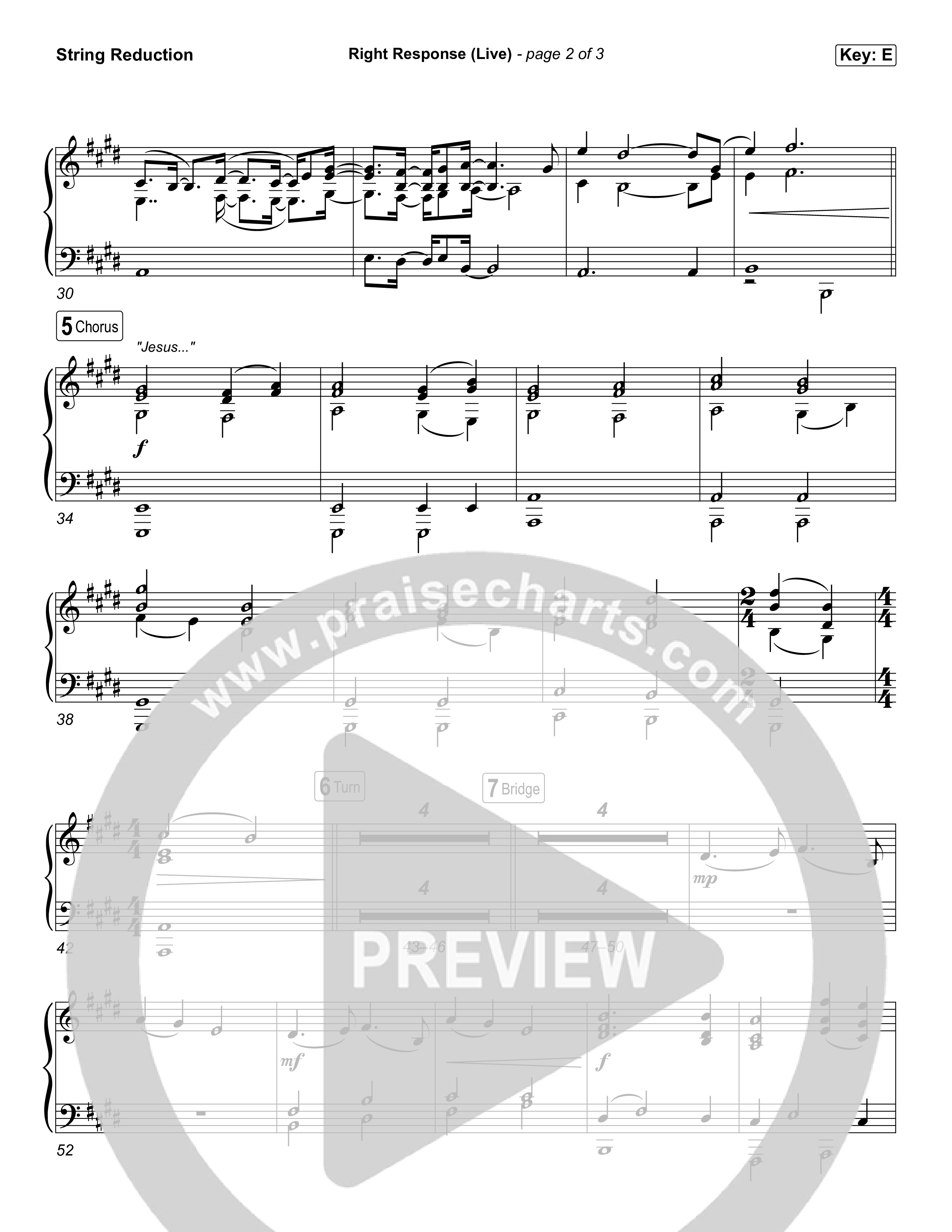 Right Response (Live) String Reduction (David's Harp)