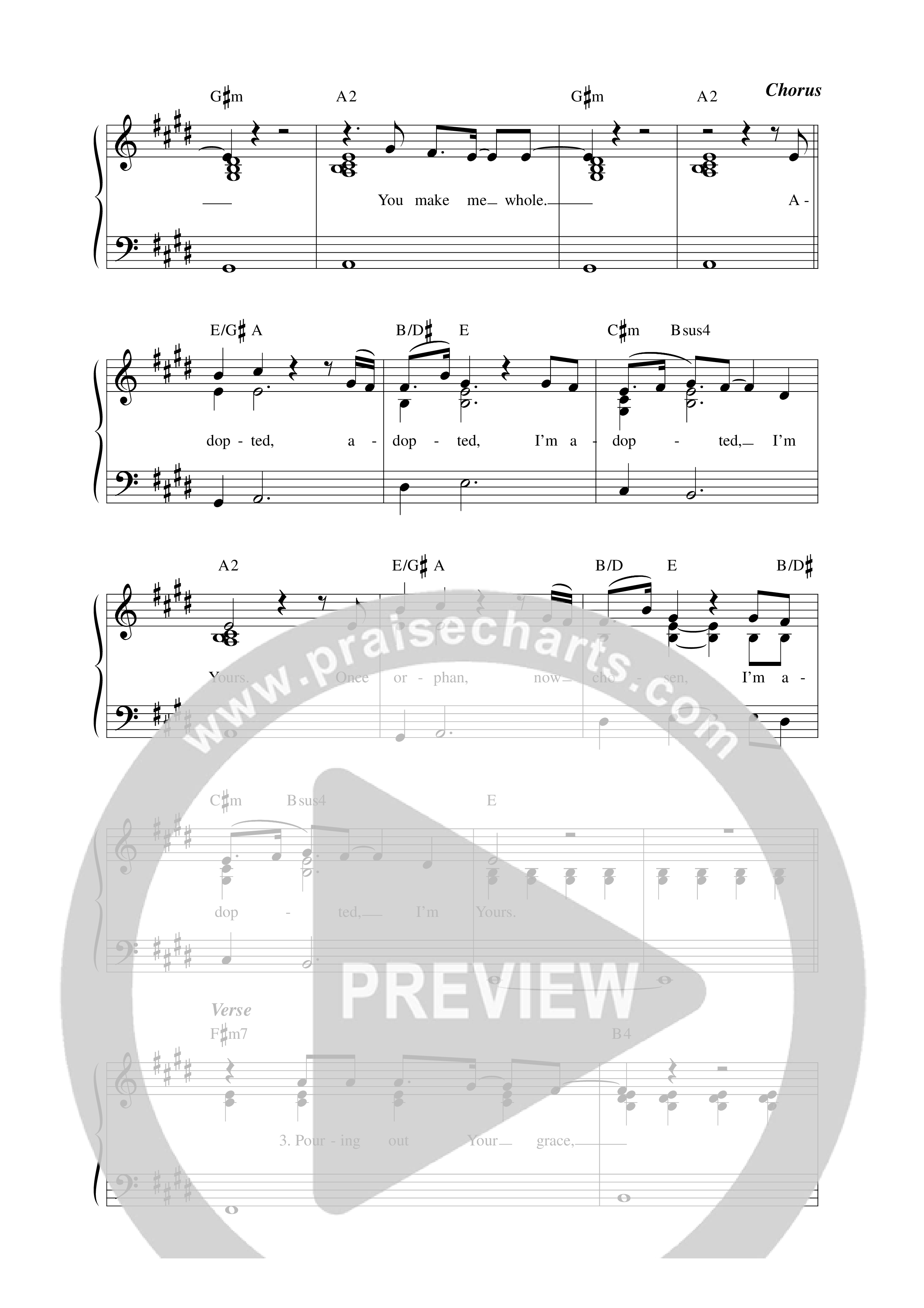 Adopted Lead Sheet Melody (Vineyard Worship)