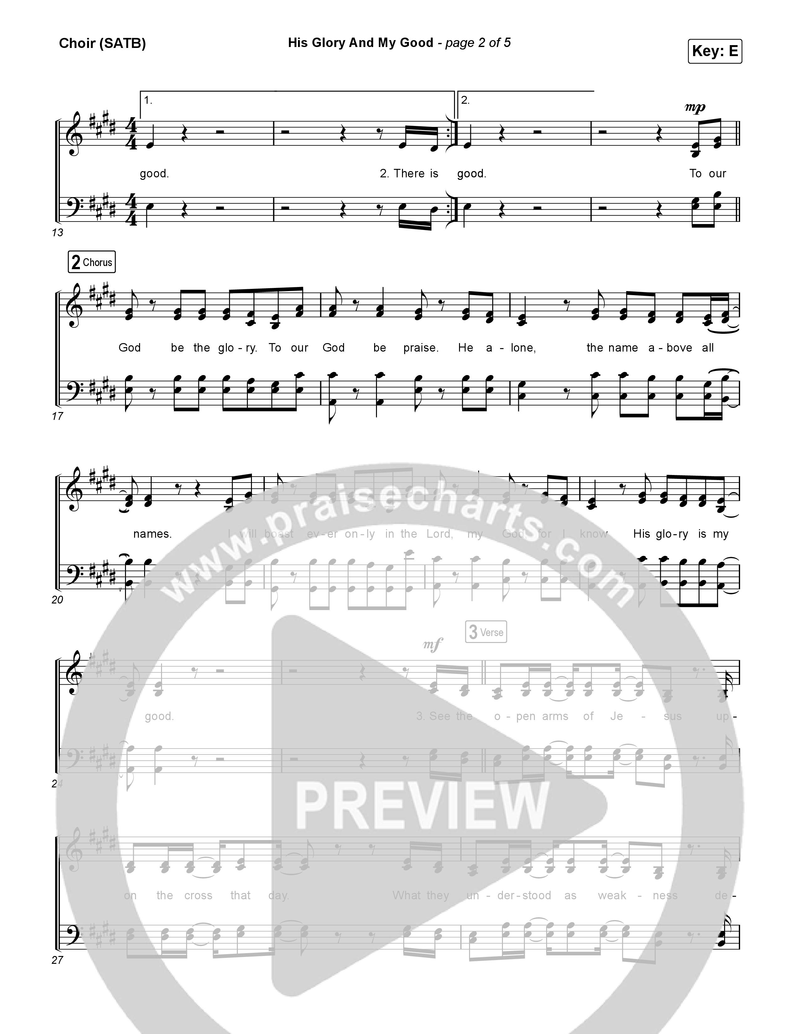 His Glory And My Good Choir Sheet (SATB) (CityAlight)