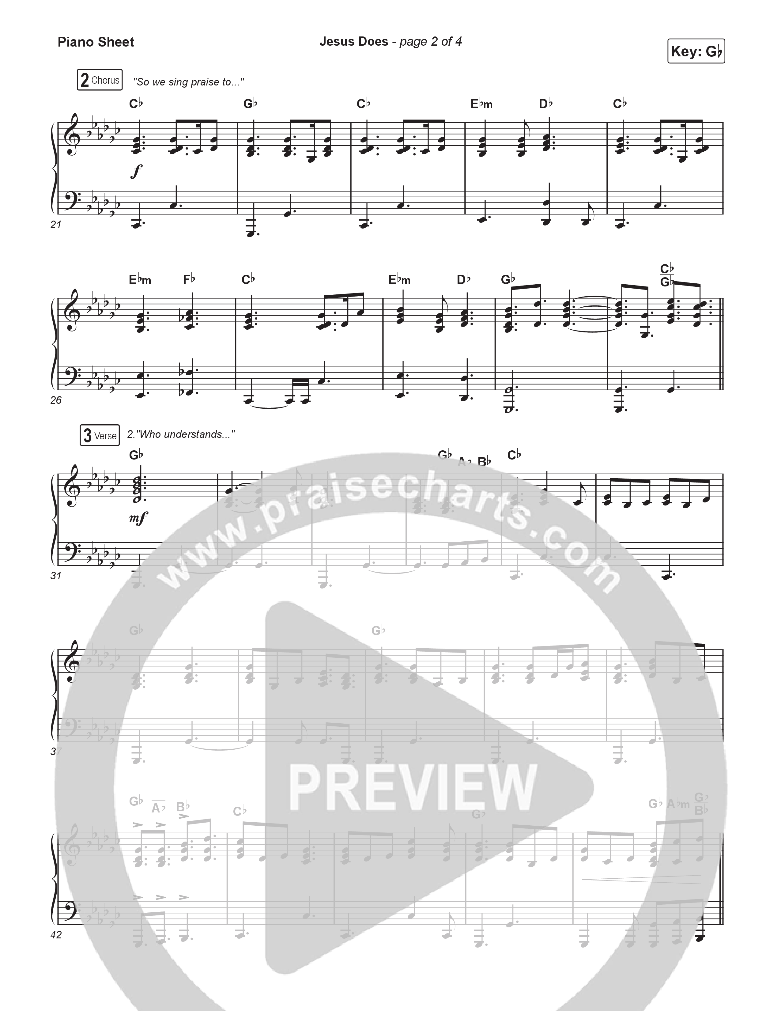 Jesus Does (Choral Anthem SATB) Piano Sheet (We The Kingdom / Arr. Luke Gambill)