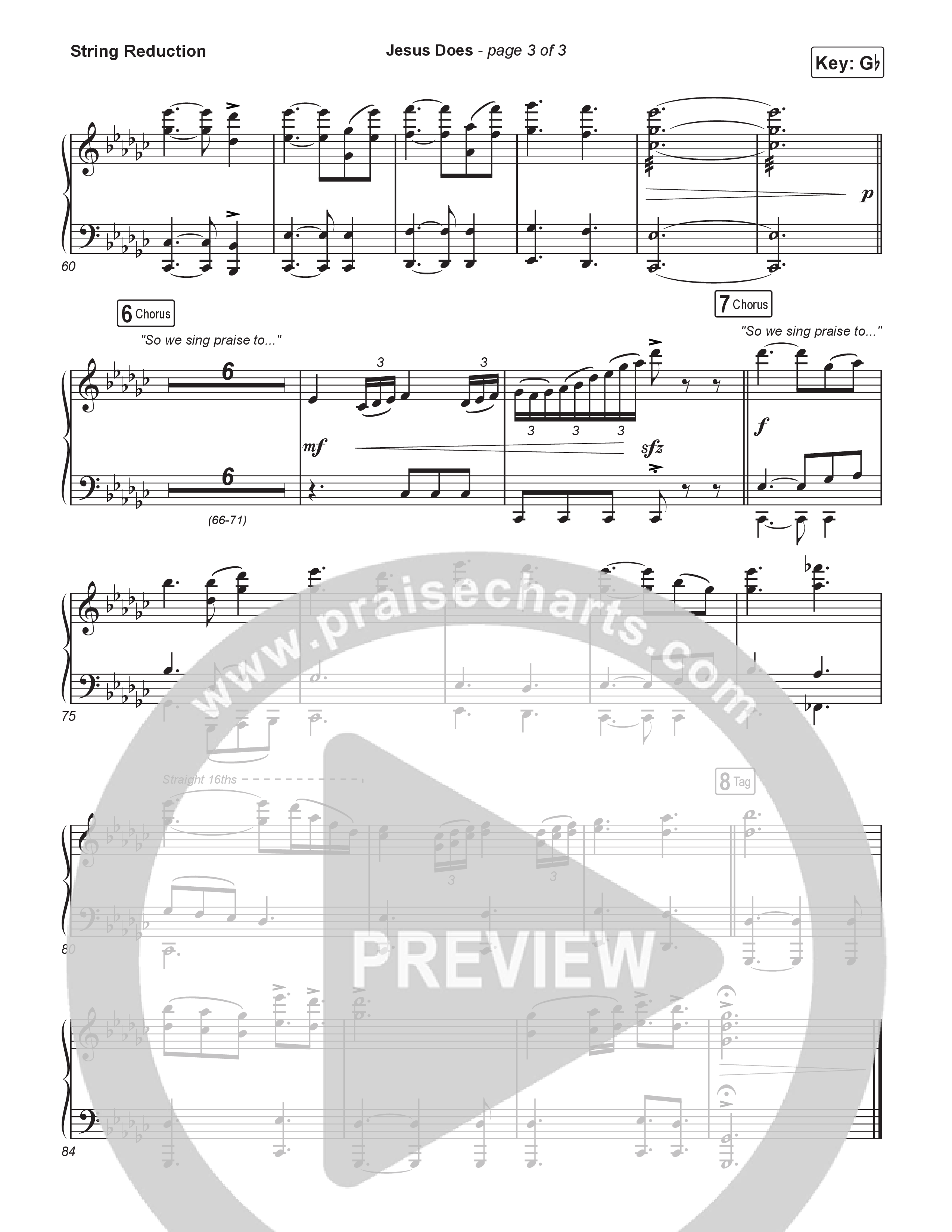 Jesus Does (Choral Anthem SATB) String Reduction (We The Kingdom / Arr. Luke Gambill)