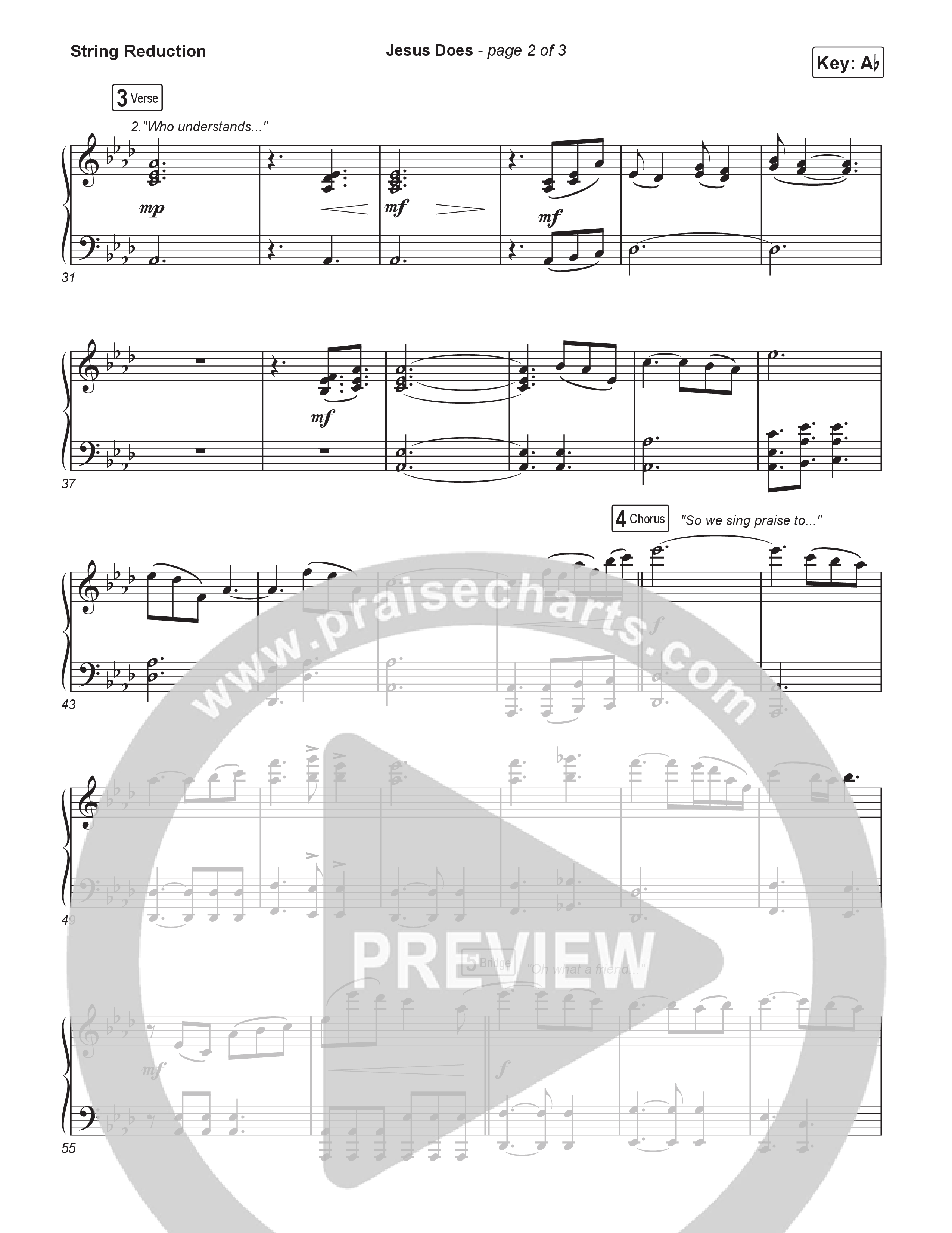 Jesus Does (Worship Choir/SAB) String Reduction (We The Kingdom / Arr. Luke Gambill)