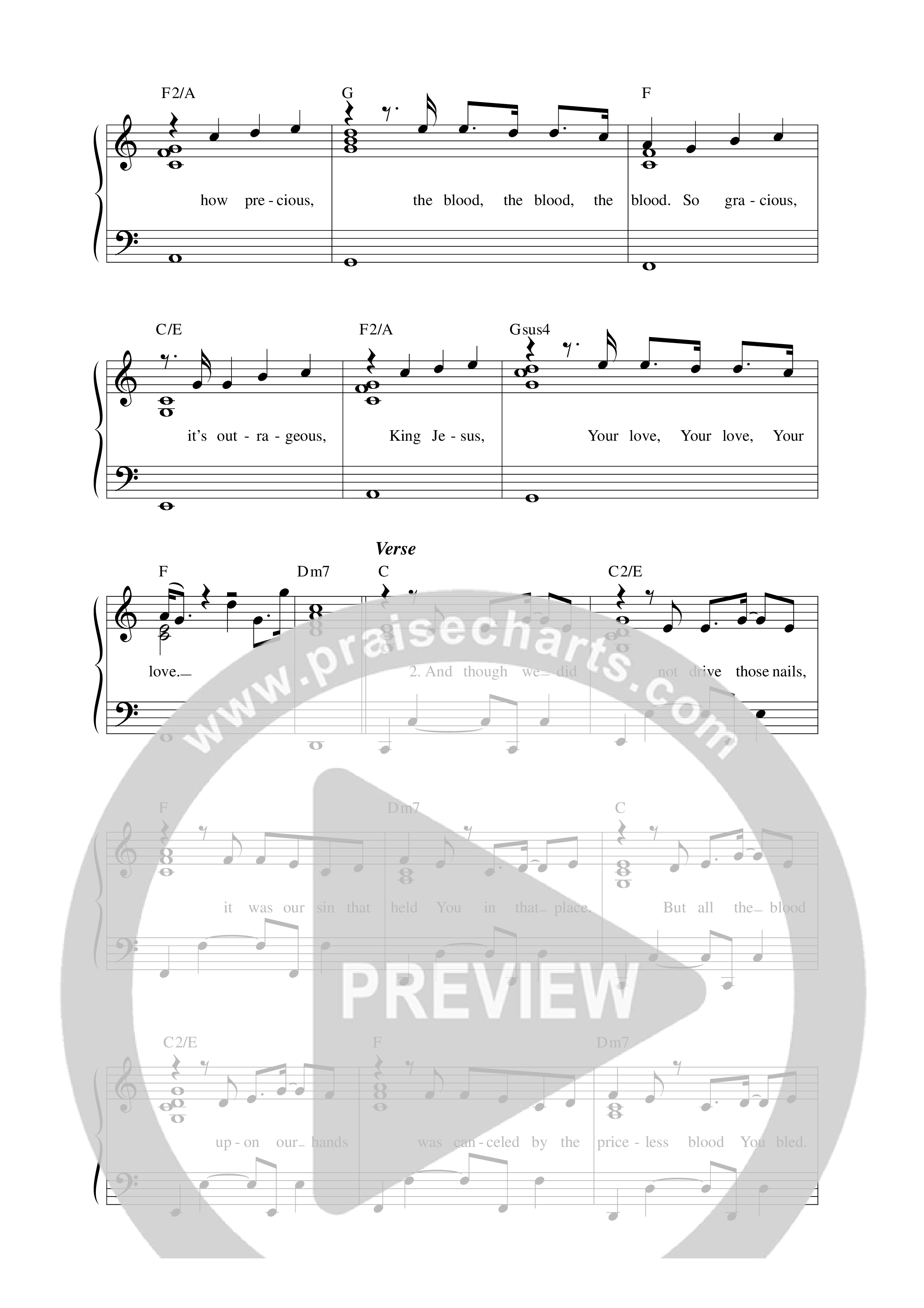 Love Is This (Live) Lead Sheet Melody (Matt Redman)