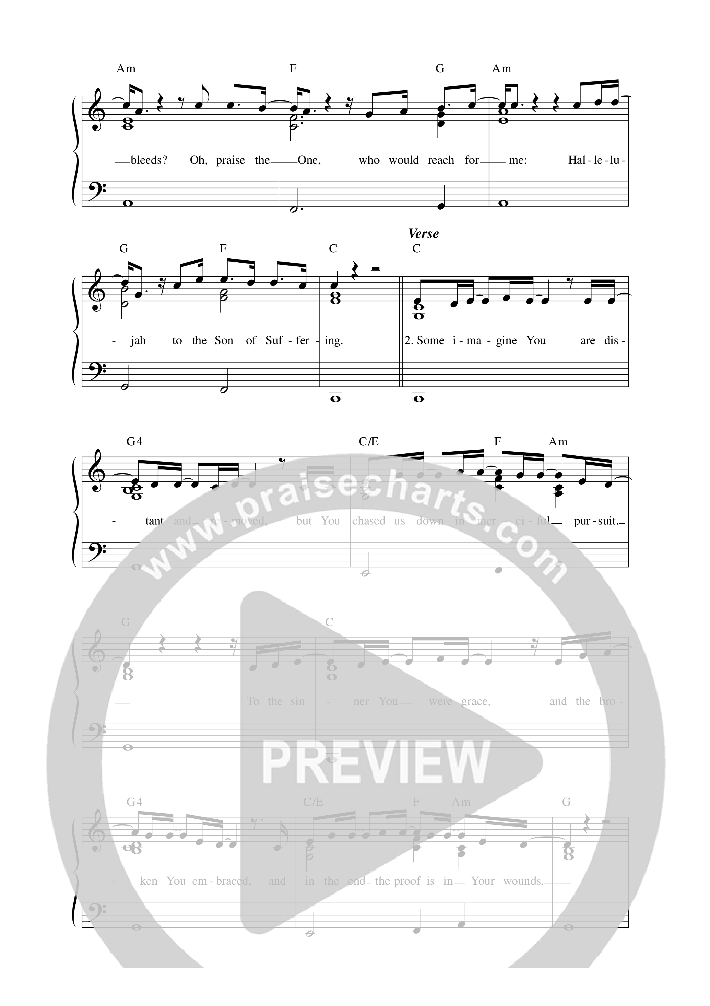 Son Of Suffering / Mercy (Live) Lead Sheet Melody (Matt Redman)