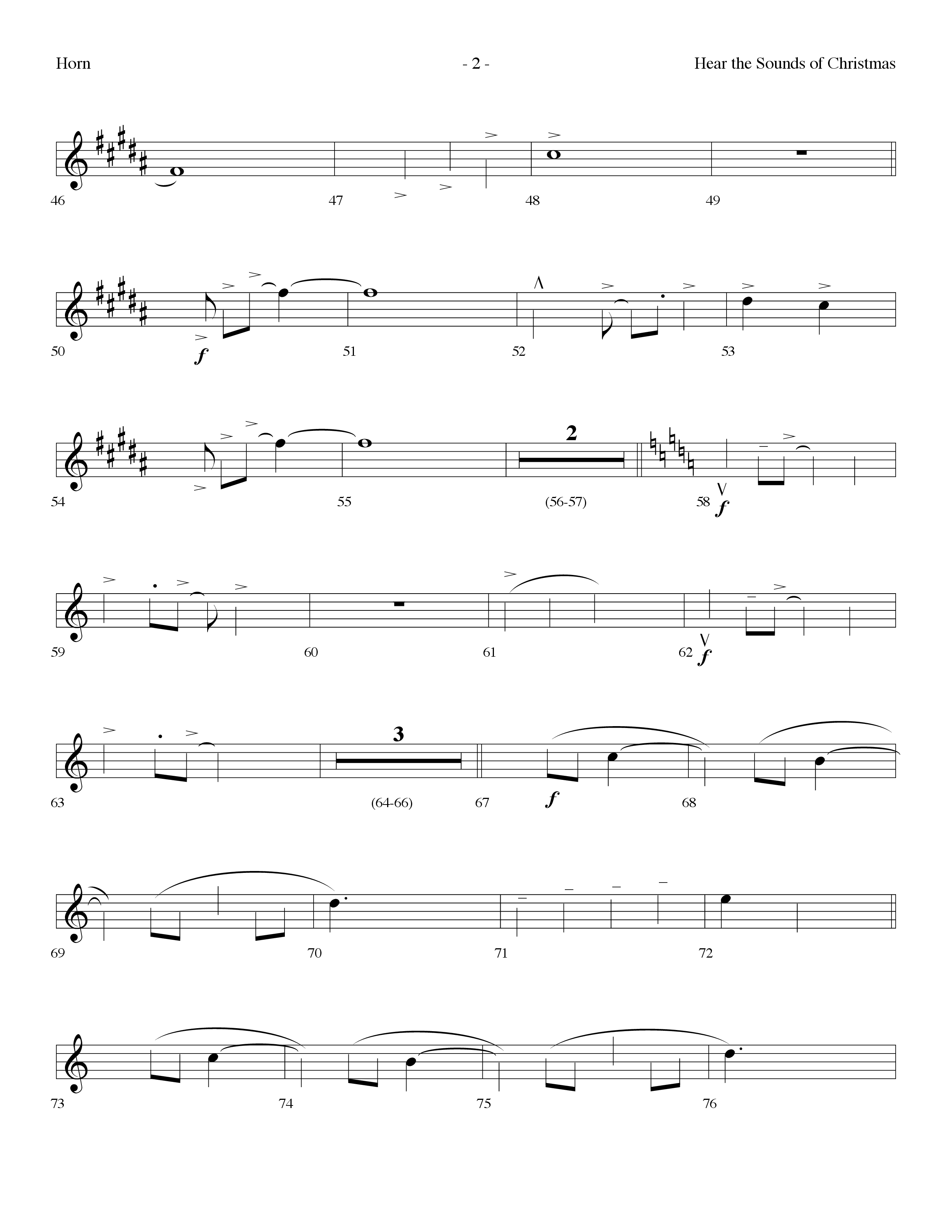 Hear The Sounds Of Christmas (with Angels We Have Heard On High) (Choral Anthem SATB) French Horn (Lifeway Choral / Arr. Dennis Allen)