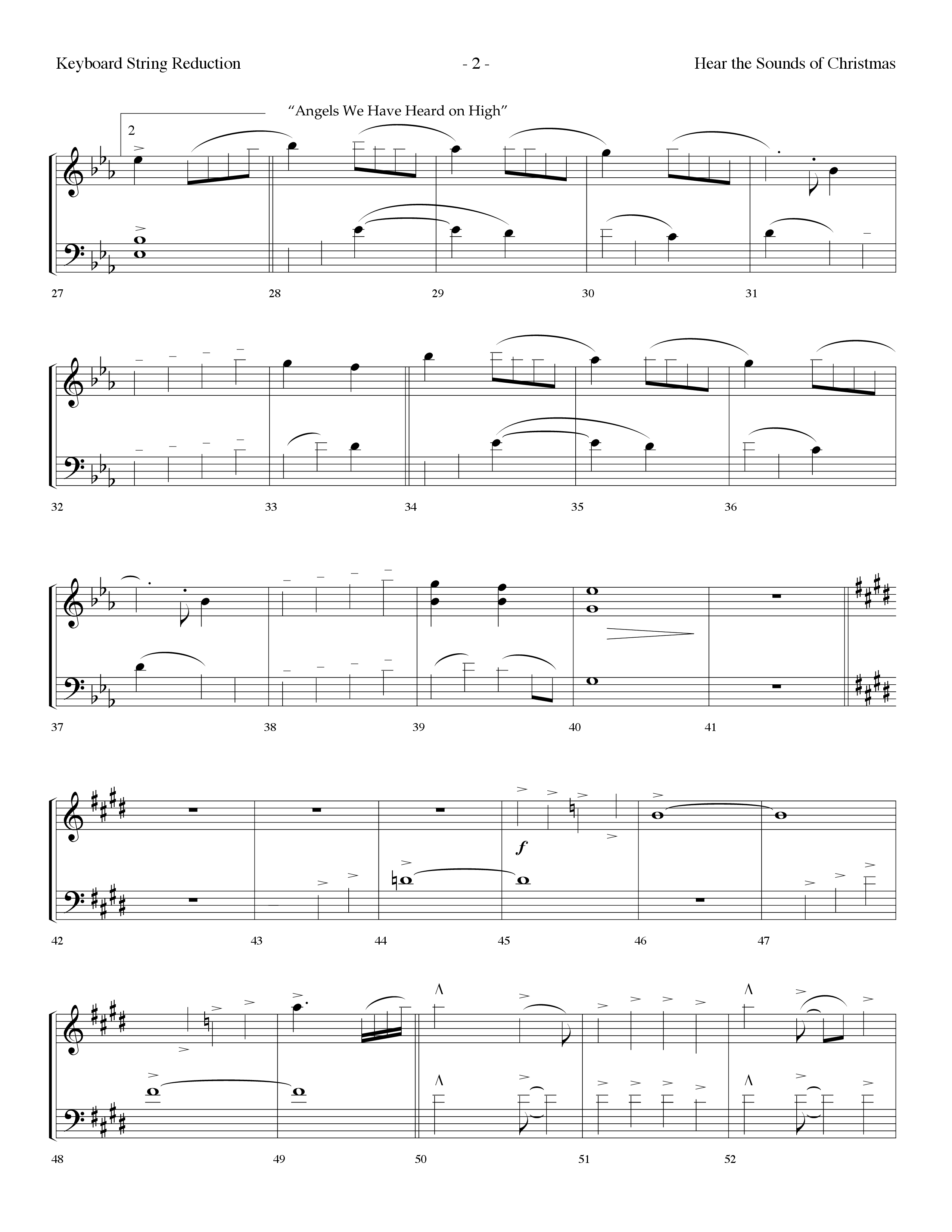 Hear The Sounds Of Christmas (with Angels We Have Heard On High) (Choral Anthem SATB) String Reduction (Lifeway Choral / Arr. Dennis Allen)