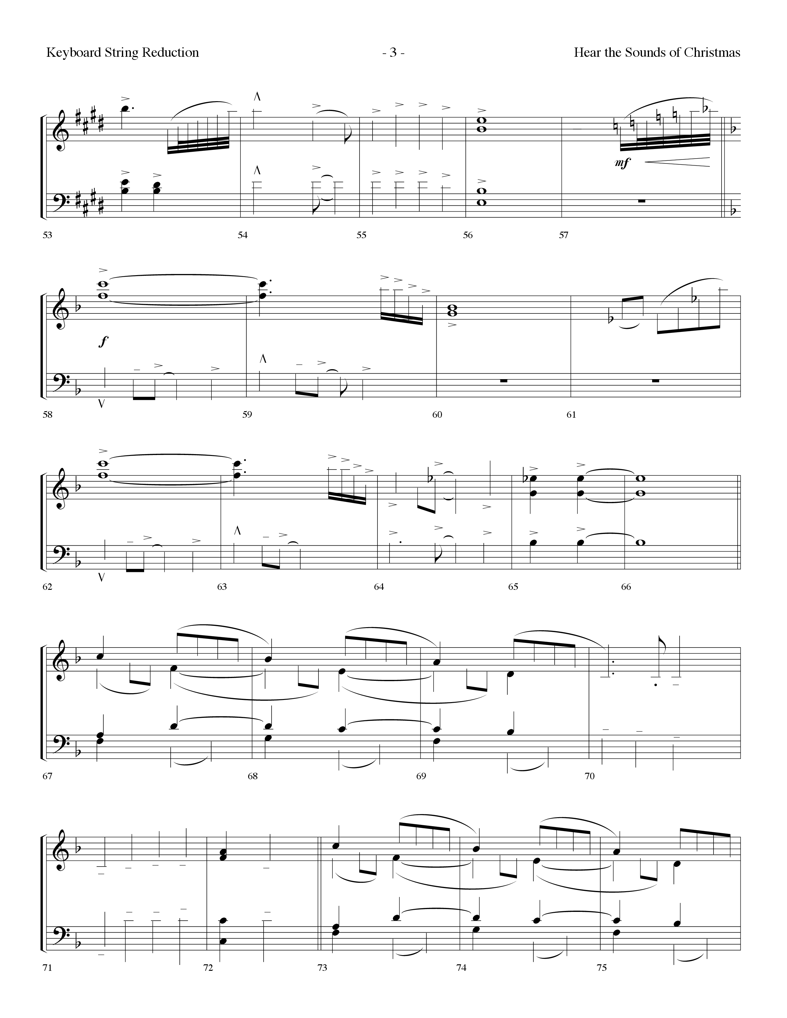 Hear The Sounds Of Christmas (with Angels We Have Heard On High) (Choral Anthem SATB) String Reduction (Lifeway Choral / Arr. Dennis Allen)