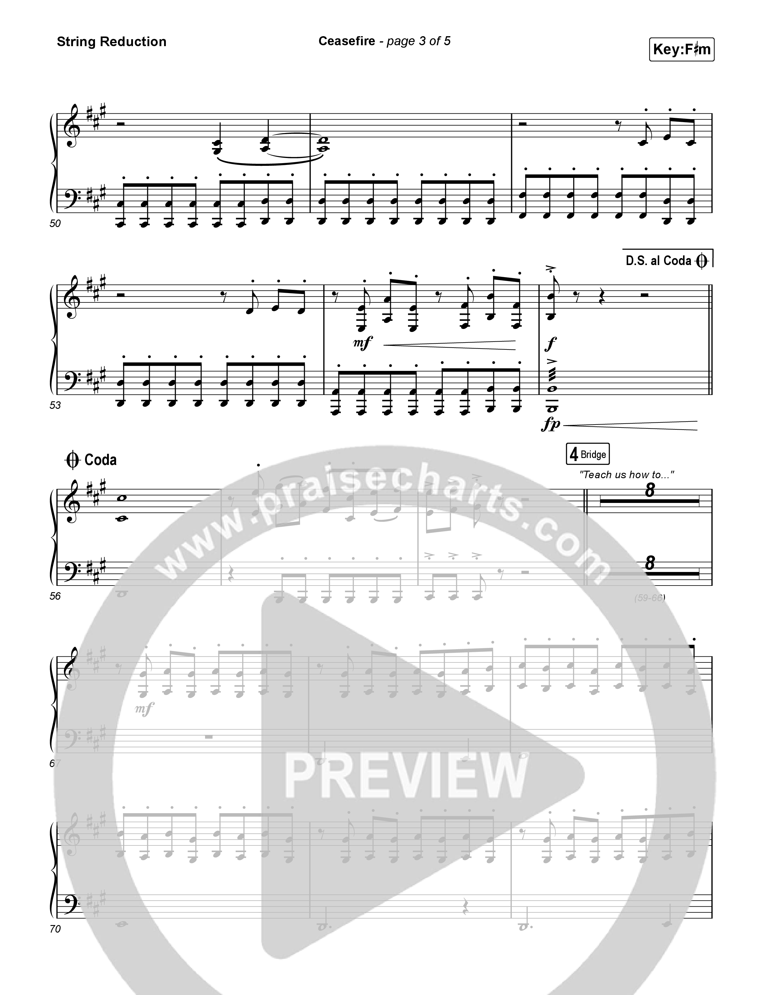 Ceasefire String Reduction (for KING & COUNTRY)