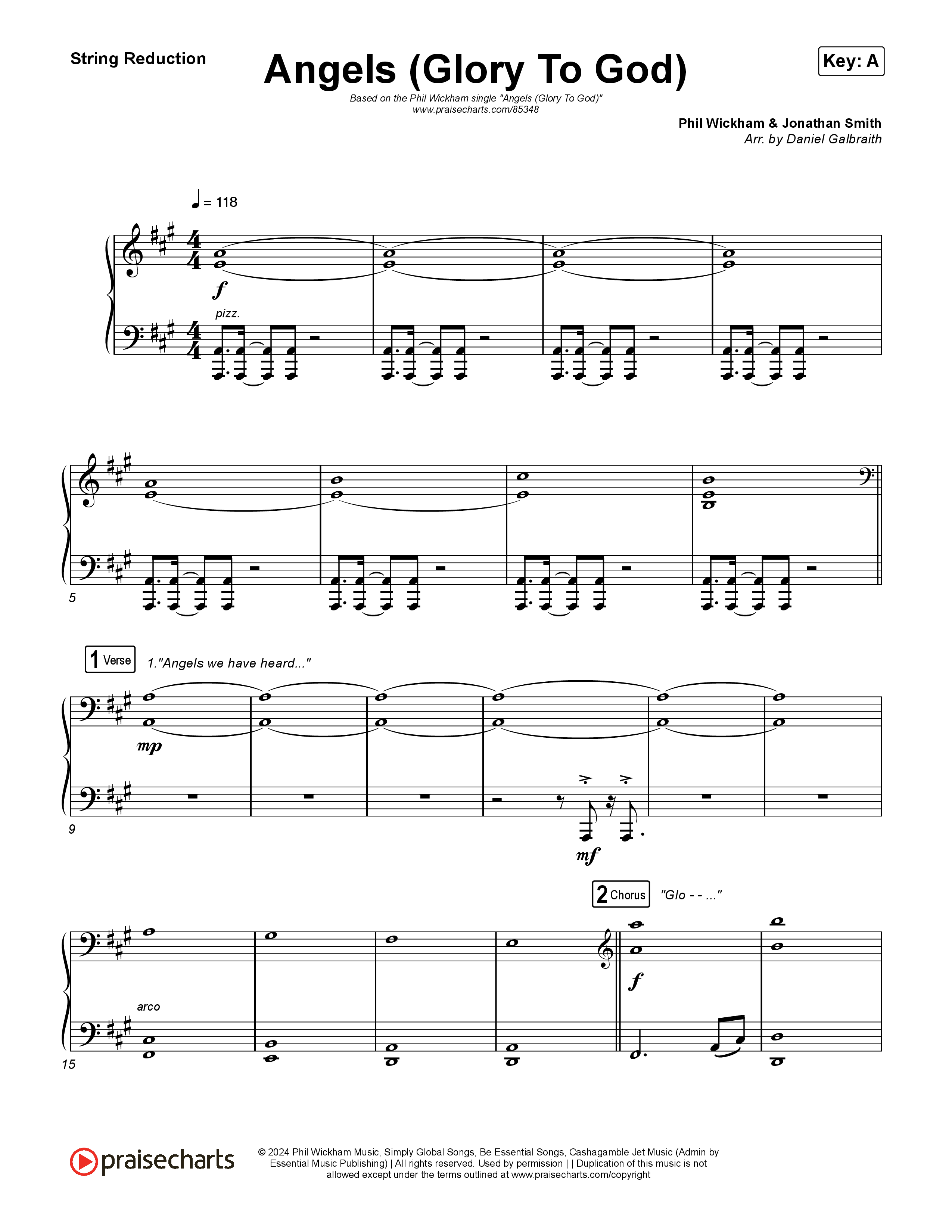 Angels (Glory To God) String Reduction (Phil Wickham)