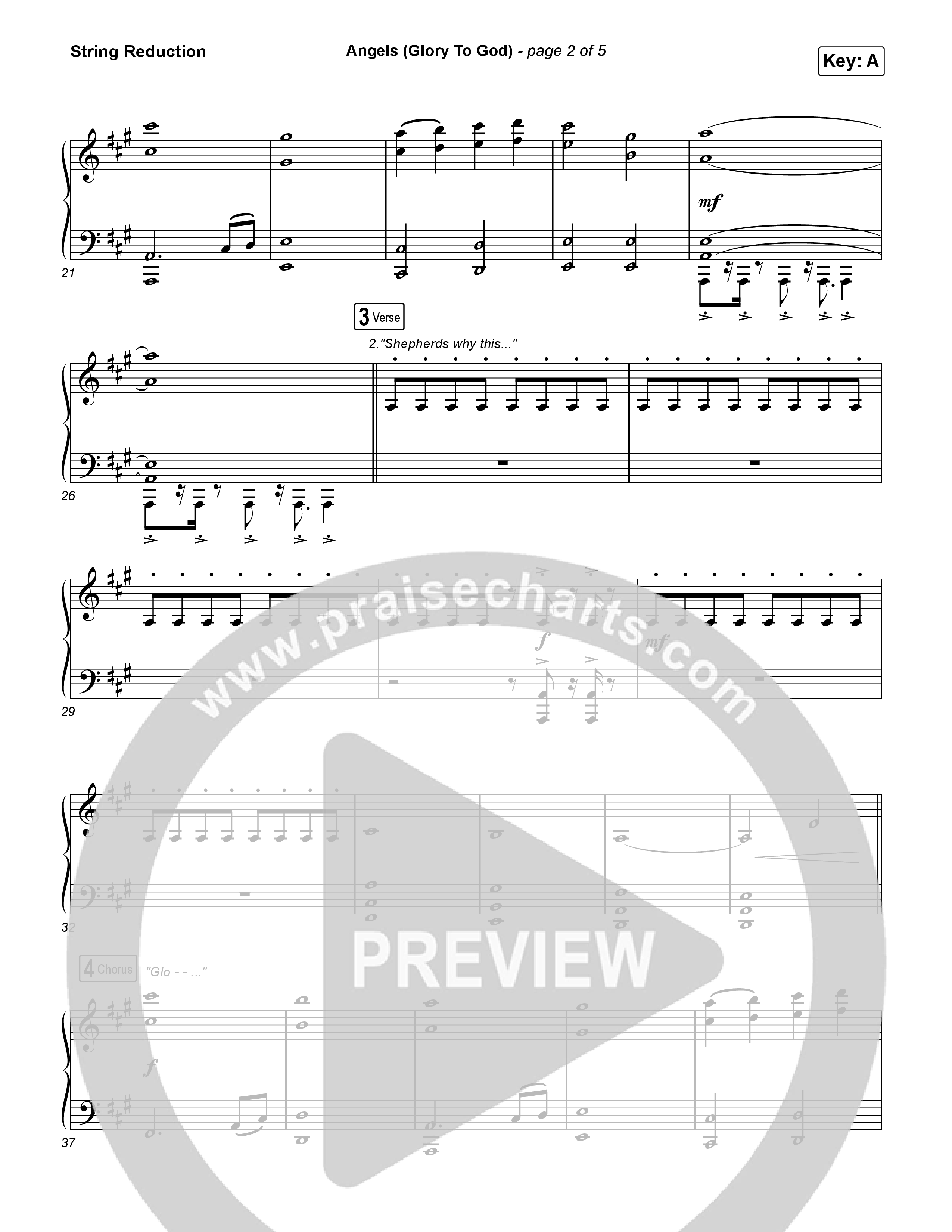 Angels (Glory To God) String Reduction (Phil Wickham)