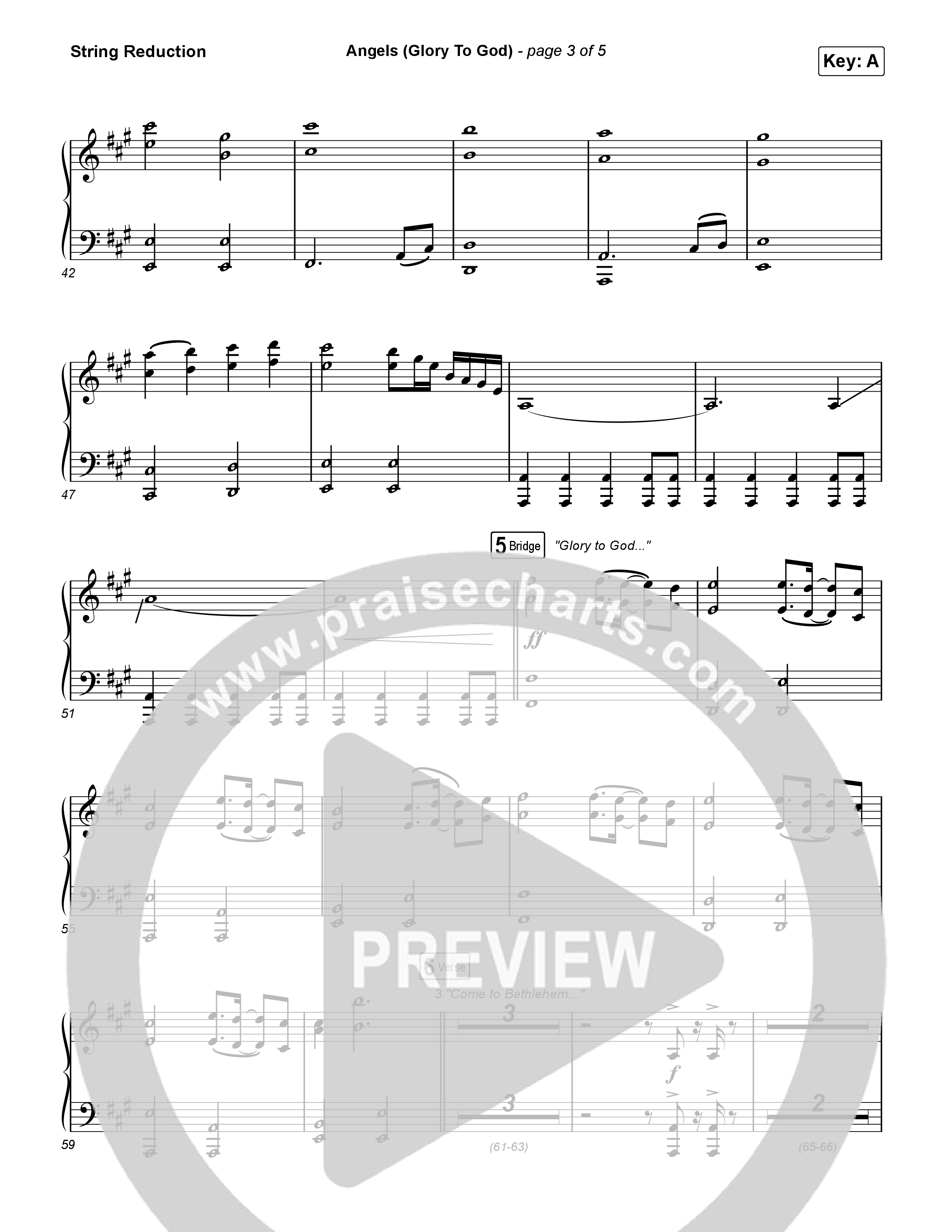 Angels (Glory To God) String Reduction (Phil Wickham)