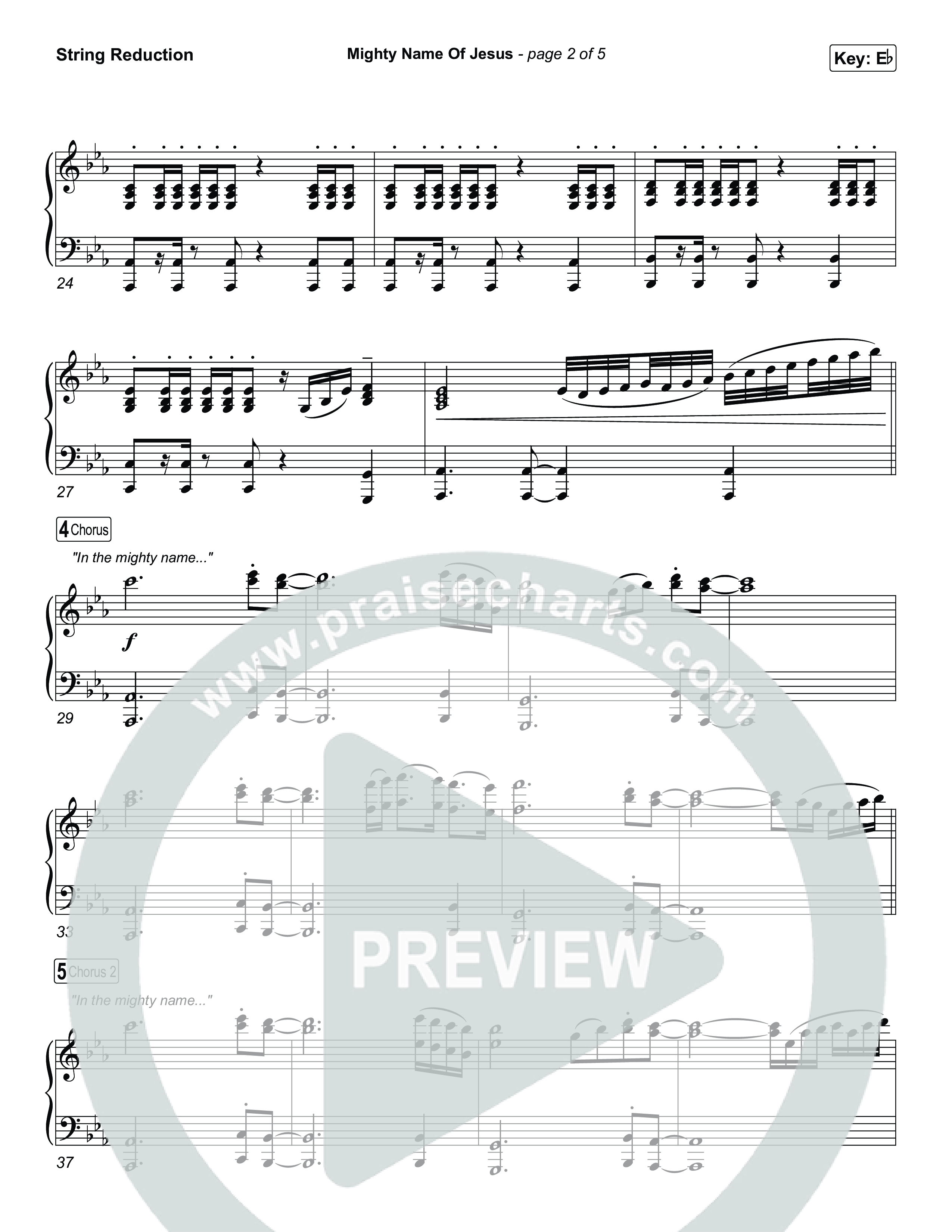 Mighty Name Of Jesus String Reduction (The Belonging Co / Hope Darst)