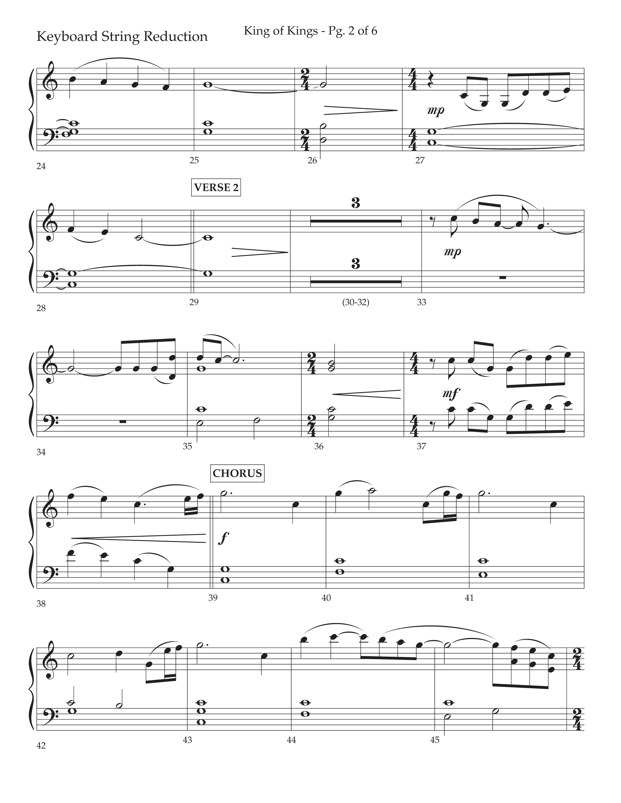 King Of Kings (with O Come Let Us Adore Him) (Choral Anthem SATB) String Reduction (Arr. John Bolin / Arr. Don Koch)